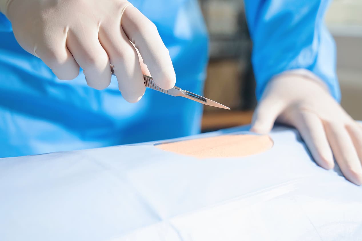 Причины, по которым люди обращаются за пластическими операциями