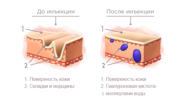 Эстетическая гинекология