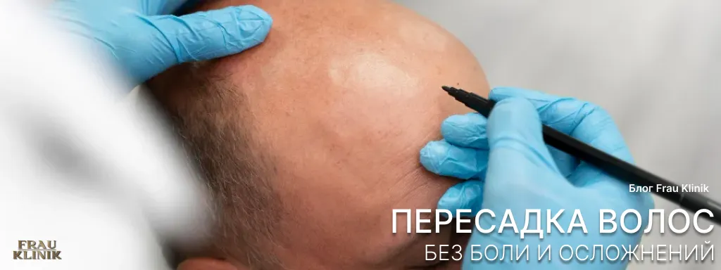 Пересадка волос без боли и осложнений
