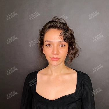 Контурная пластика