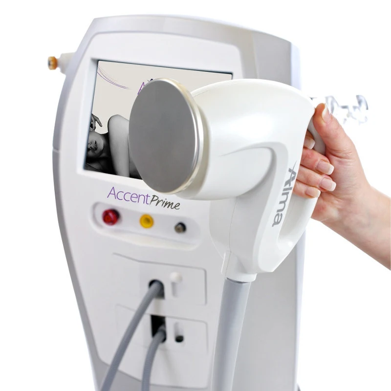 Accent (Alma Lasers)