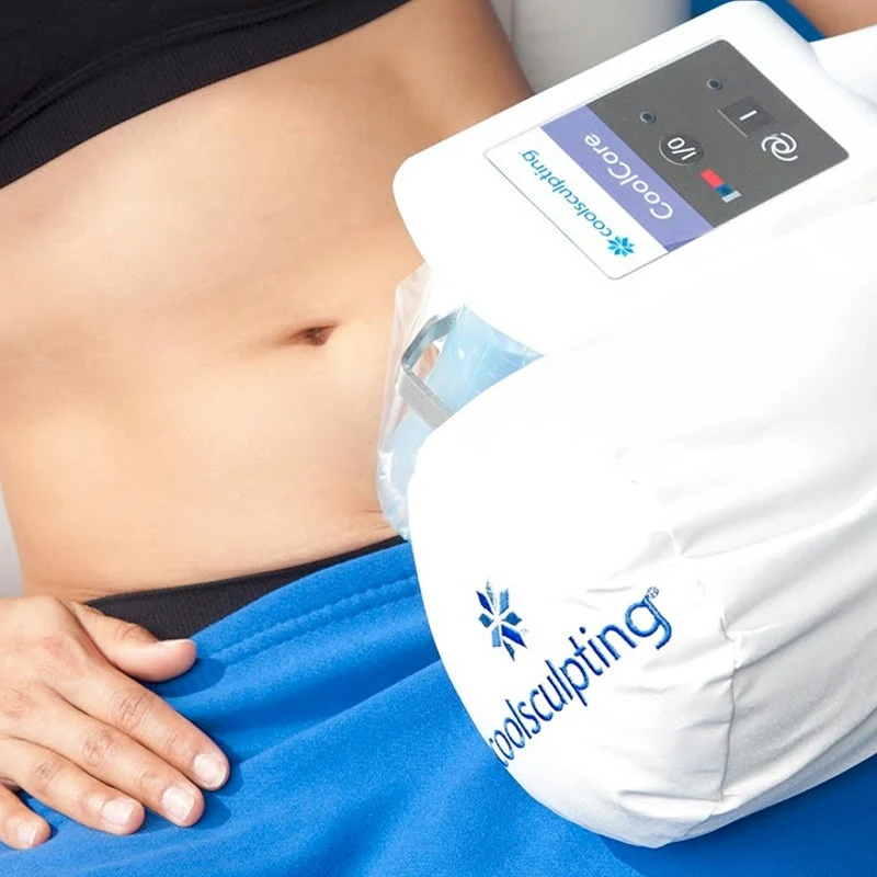CoolSculpting