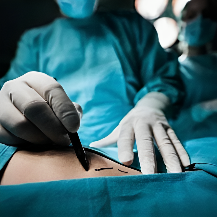 Самые популярные пластические операции 2023 года